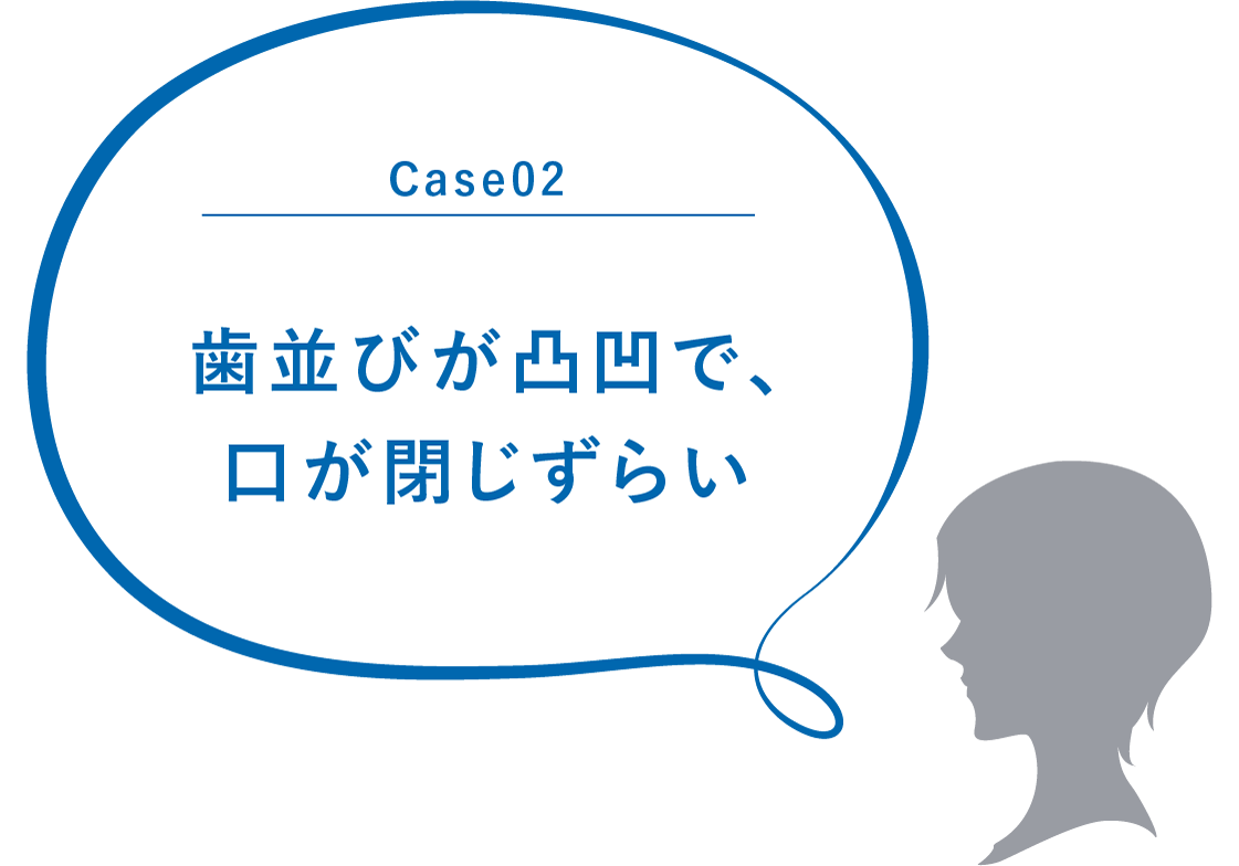 Case02 歯並びが凸凹で、口が閉じずらい